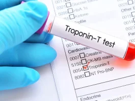 Troponin Nedir? Normal Değeri Kaç Olmalı, Yüksekliği ve Aralığı