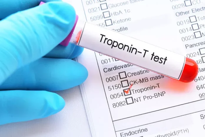 Troponin Nedir? Normal Değeri Kaç Olmalı, Yüksekliği ve Aralığı