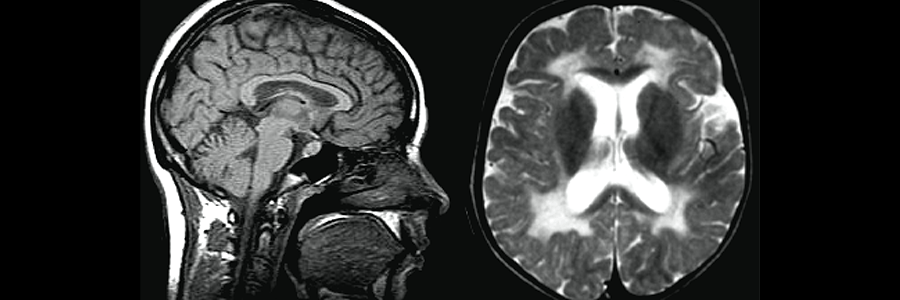 İlaçlı Tomografi Nedir? Neden Çekilir, Sonucu Ne Zaman Çıkar?