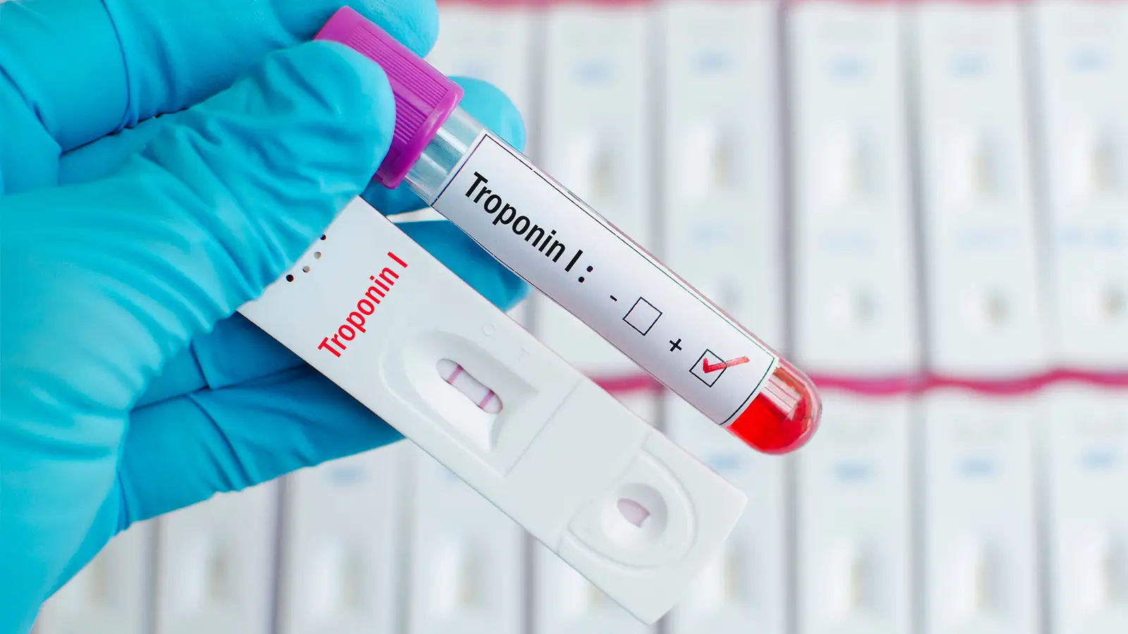 Troponin Nedir? Normal Değeri Kaç Olmalı, Yüksekliği ve Aralığı