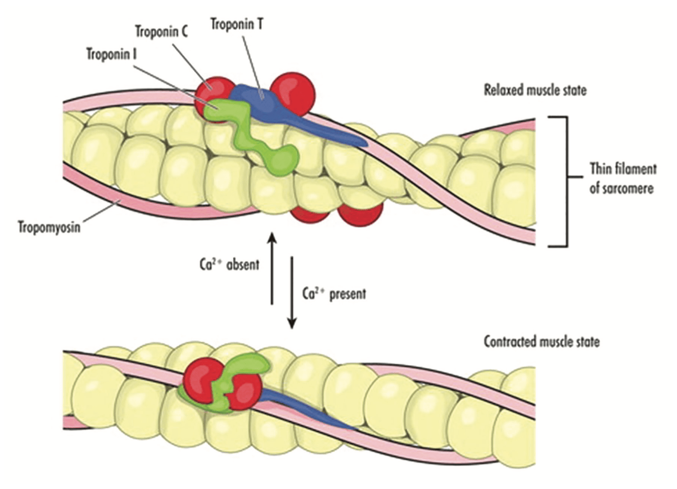 Troponin Nedir? Normal Değeri Kaç Olmalı, Yüksekliği ve Aralığı