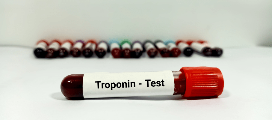 Troponin Testi Örneği