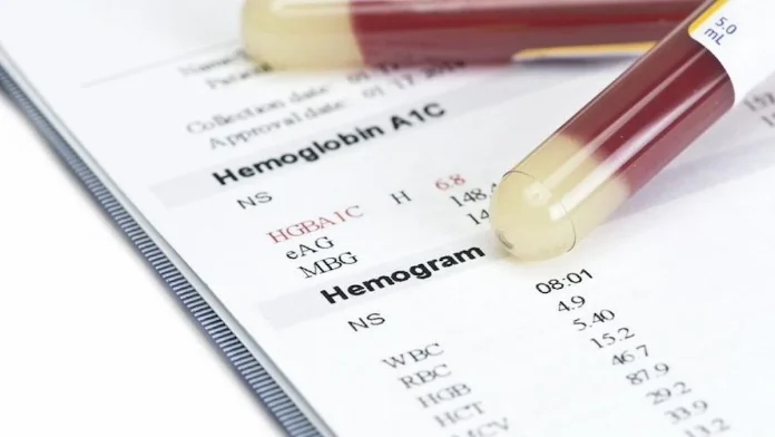 Hemogram Nedir, Ne Demek? Testi Nedir, Nasıl Yapılır, Ne Kadar Sürer?