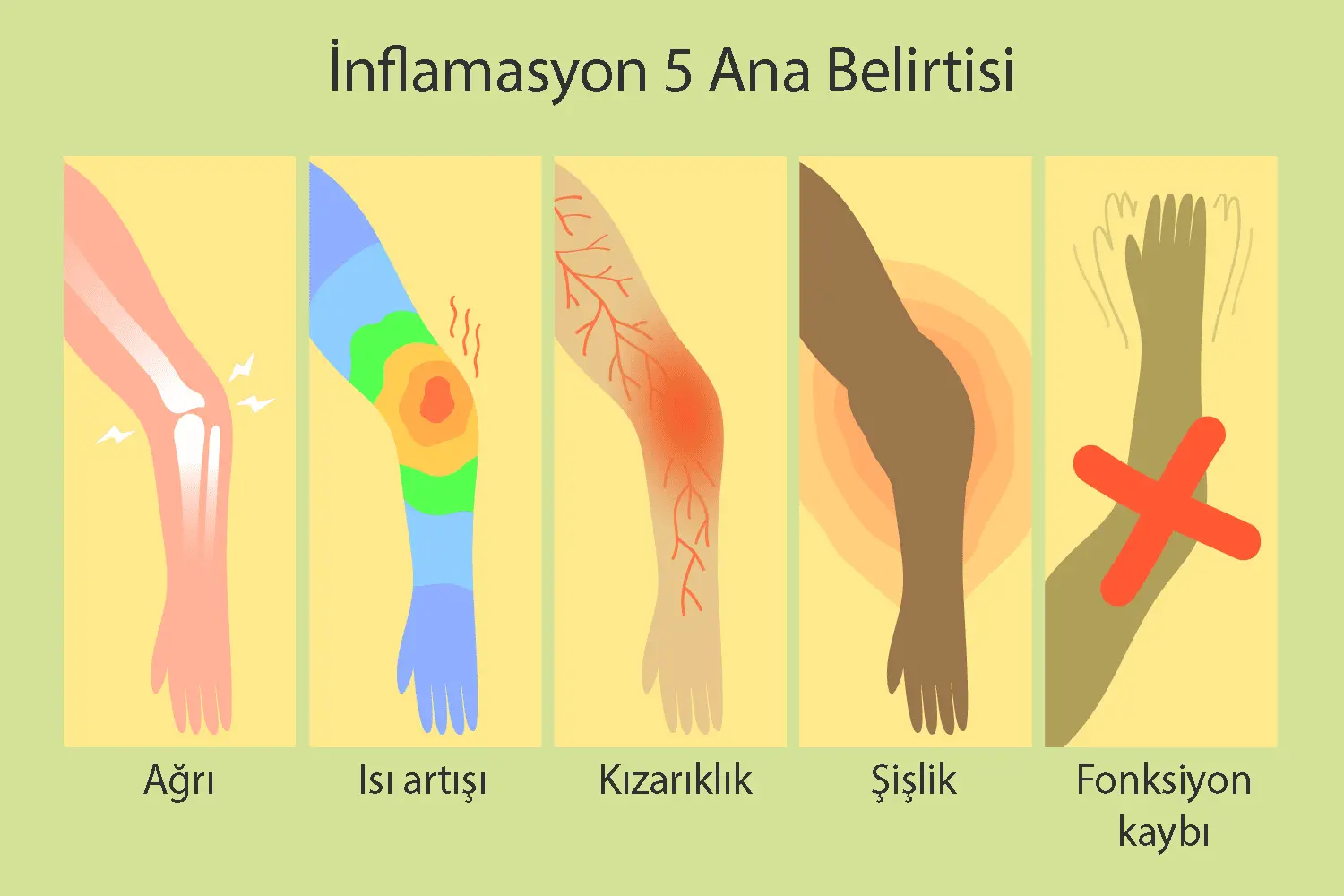İnflamasyon Nedir? Belirtileri, Türleri, Nedenleri ve Tedavi Yöntemi