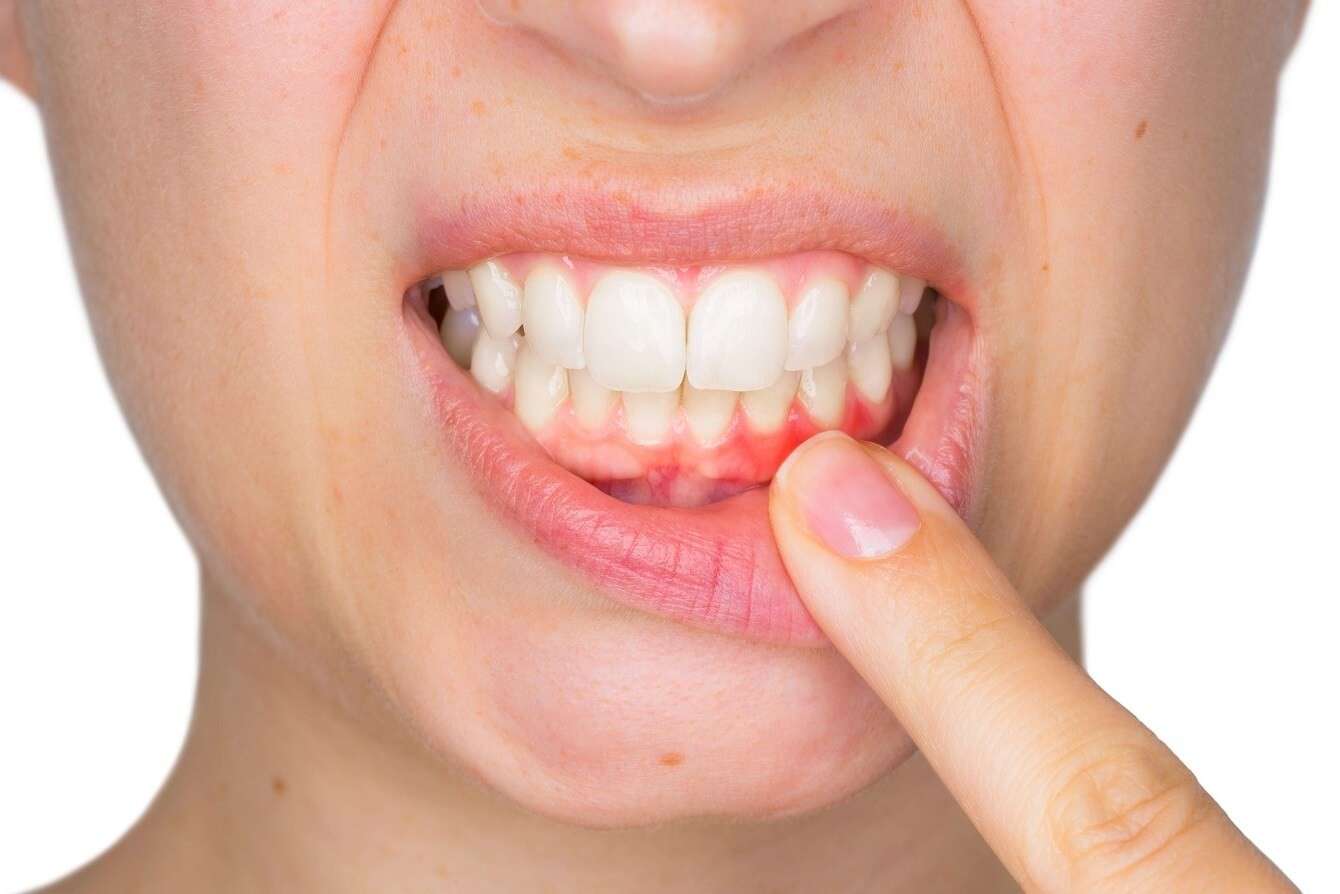 Periodontoloji Nedir? Periodontoloji ve Ağız Sağlığına Yaptığı Etkiler!