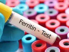 Ferritin Nedir? Düşüklüğü, Yüksekliği, Normal değeri Kaçtır?