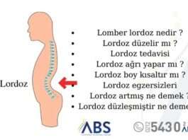 Lordoz nedir?