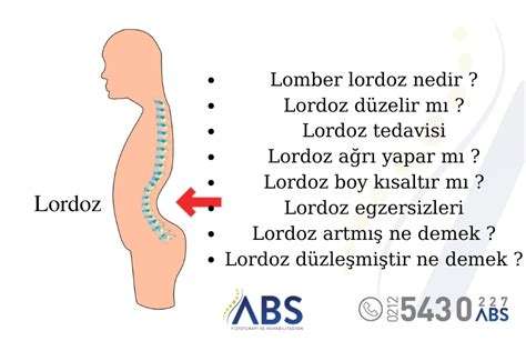 Lordoz nedir?