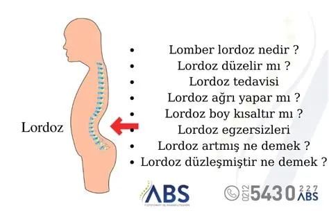 Lordoz nedir?