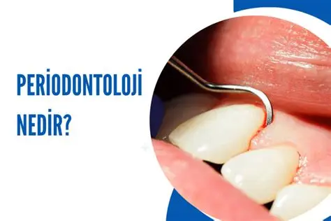 Periodontoloji nedir? Periodontoloji nedir?